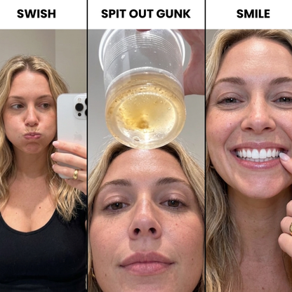 AquaSmile Stain Whitening Mouthwash
