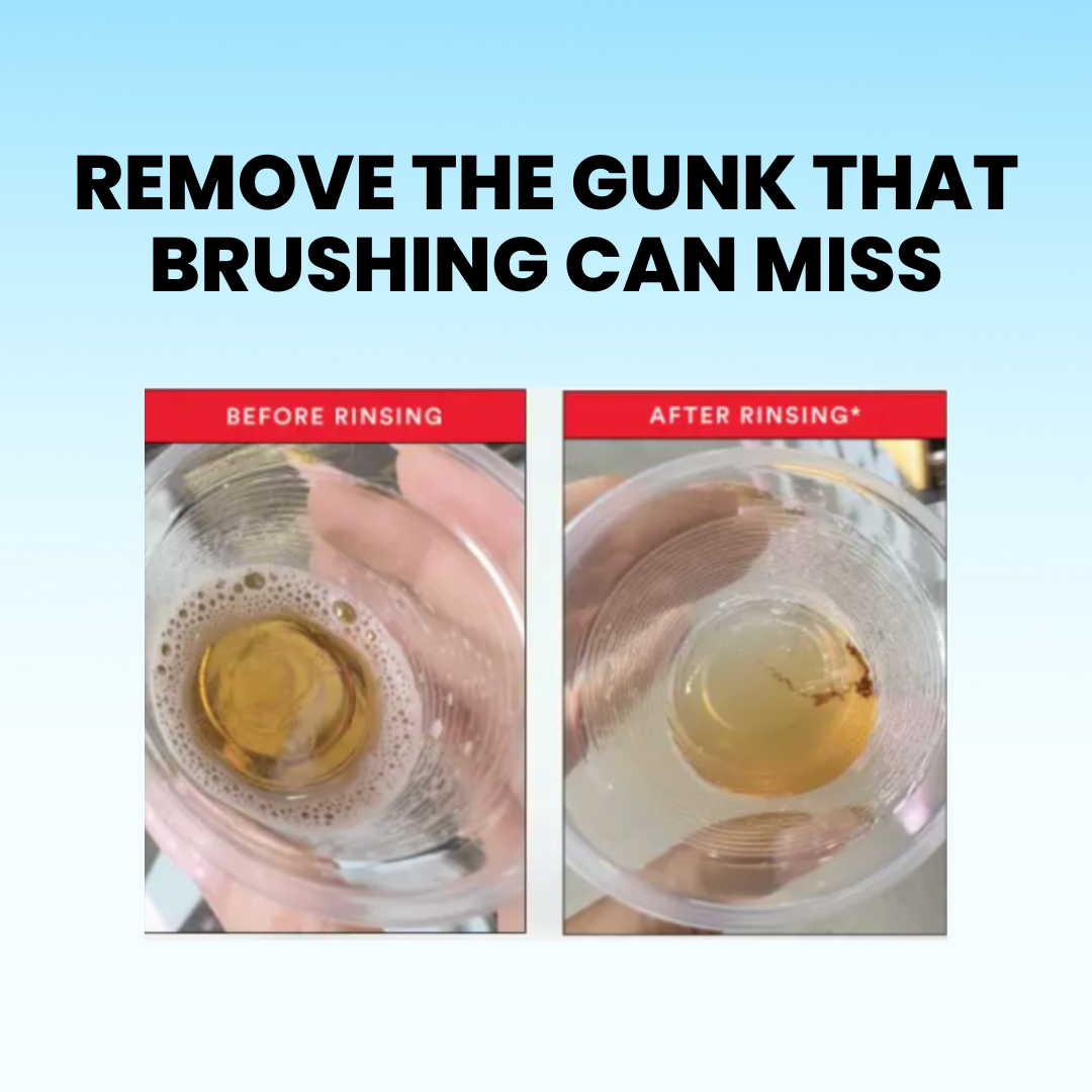 AquaSmile Stain Whitening Mouthwash