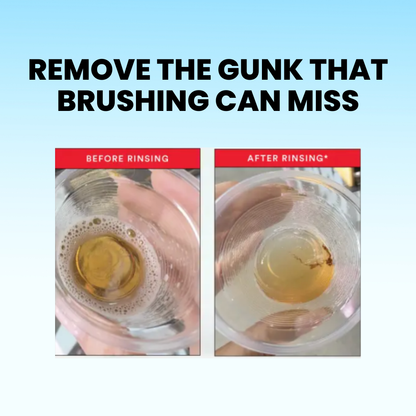 AquaSmile Stain Whitening Mouthwash