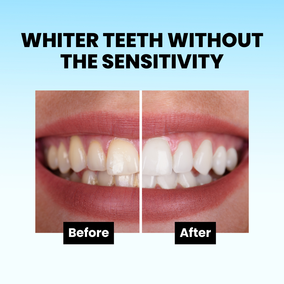 AquaSmile Stain Whitening Mouthwash