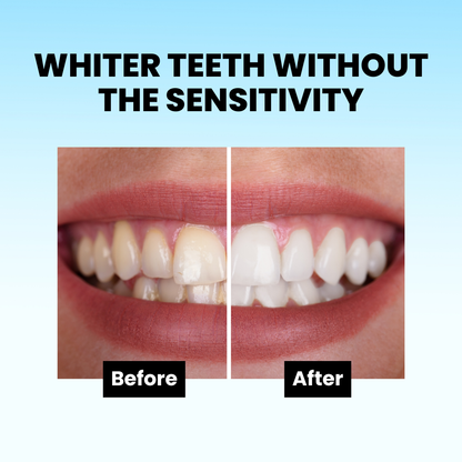 AquaSmile Stain Whitening Mouthwash